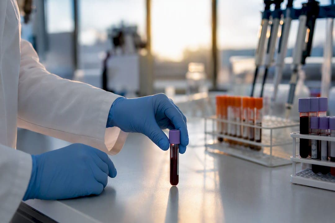 CBC Differential Explained: What Your Results Mean